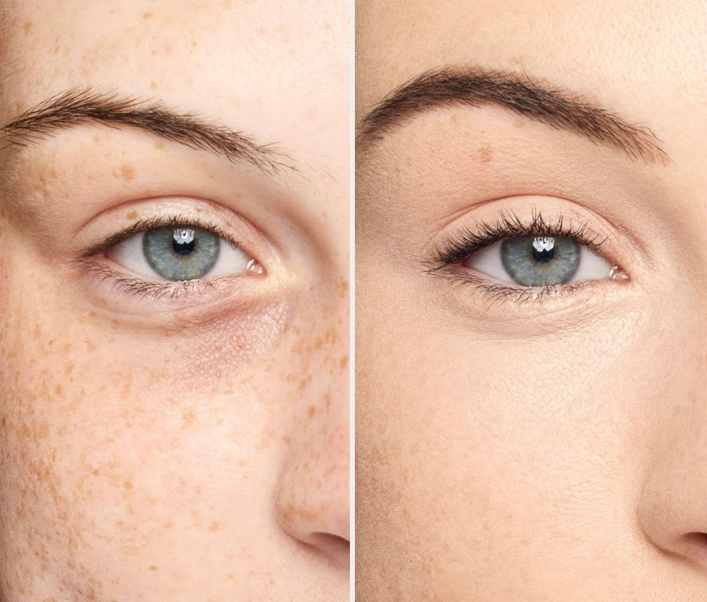 UNDER EYE ERASER