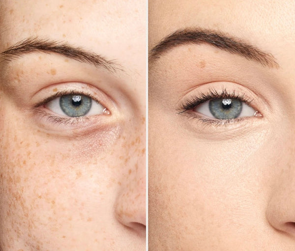 UNDER EYE ERASER